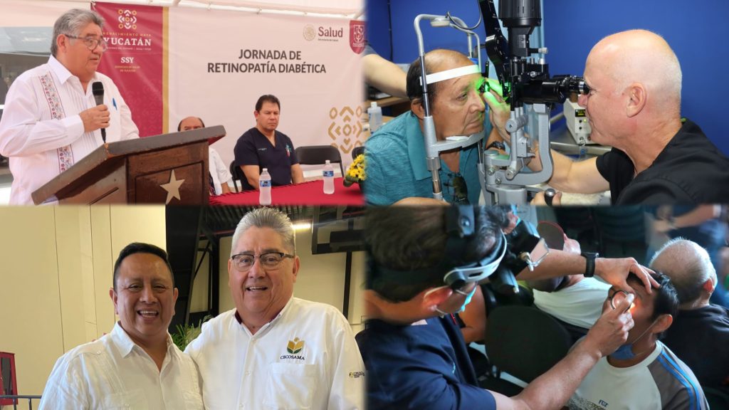 Jornada de salud en Yucatán beneficia a pacientes con Retinopatía Diabética